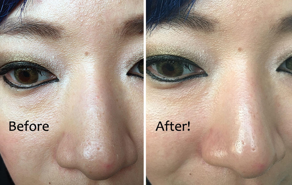 CNP Anti-Pore Blackheads Perfect Clear Kits Nose Scrubs Exforliators