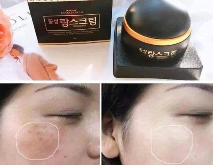 Dongsung Rannce Creams 70G Korean Beauty Cosmetics Womens Skin Care freckles blemish brightening Wrinkles Finelines