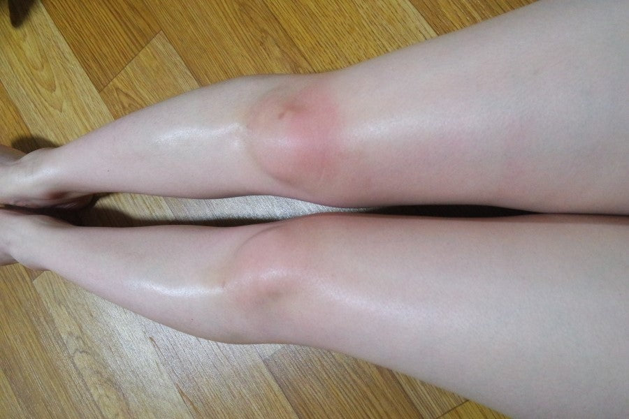 Elizavecca Milky Piggy Belly Line K.O Double Action P.P Cream 100ml