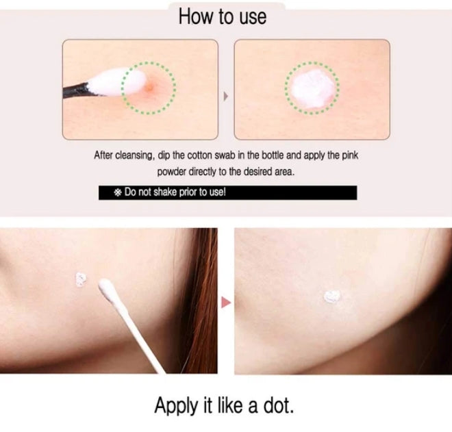 The Yeon Refining Calamine Pink Spot Womens Beauty Cosmetics trouble