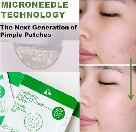 ACROPASS Skin Trouble Cure Acne Microneedle Pimple Patch (6 Patches)