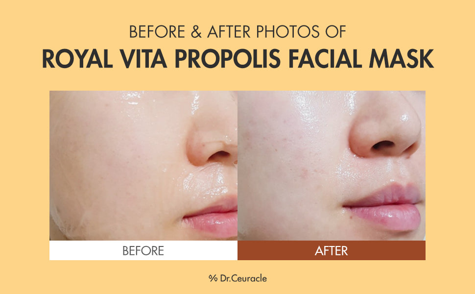 Dr.Ceuracle Royal Vita Anti-oxidant Masks 10 Sheets Korean Skincare Nourishing Anti-Aging sensitive skincare