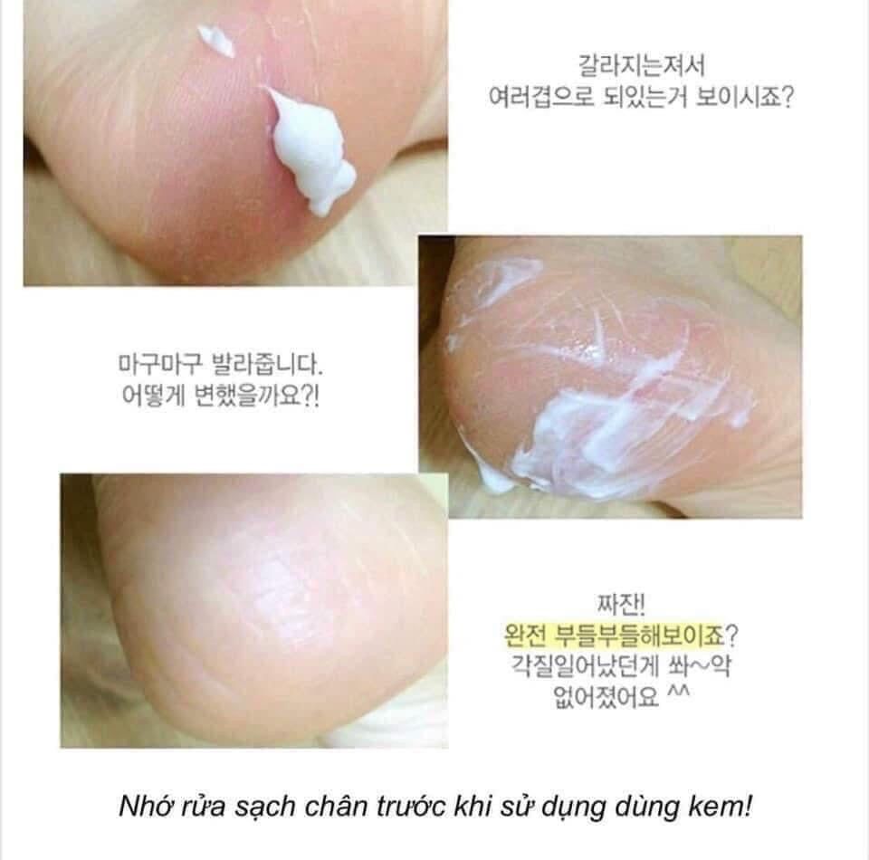 Il-Yang Pharmaceutical Foot Care Creams 60g treats cracked heels