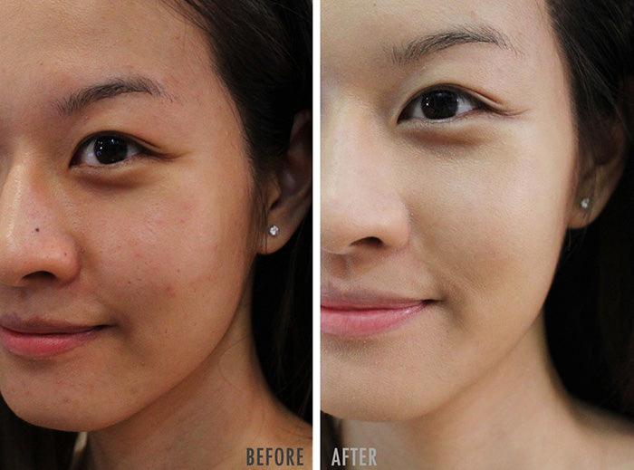 BNBG Banobagi Vita Tea Tree Healing Face Mask Pack Skin Care Pore Tightening