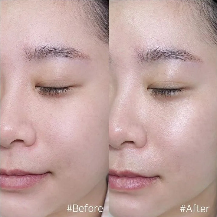 COSNORI The Perfect Whitening EX Ampoule Sets Facial Skincare Moisture Gifts brighten Niacinamide Melanin reducing hyperpigmentation Freckle Blemish