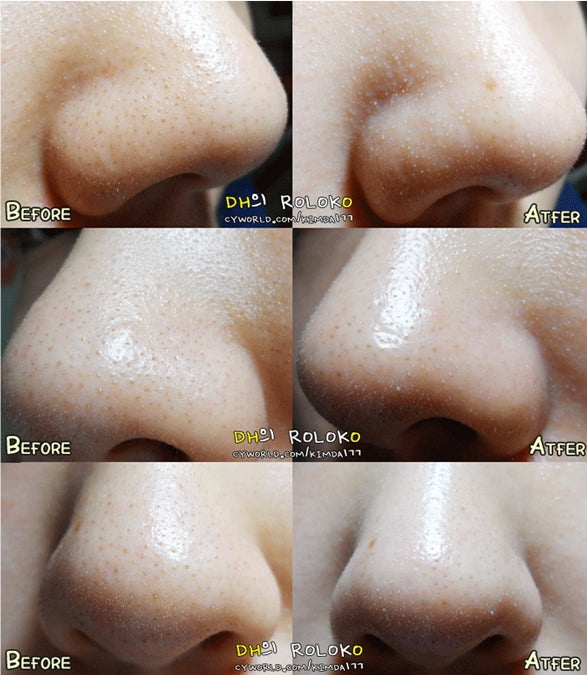 Ciracle Blackhead Off Cotton Mask Korean Skincare Cosmetics Womens