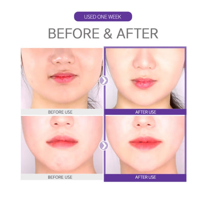 DAYCELL Dr.Band 2 STEP Volume & Lifting 6g Neck Line Sagging Skin Care