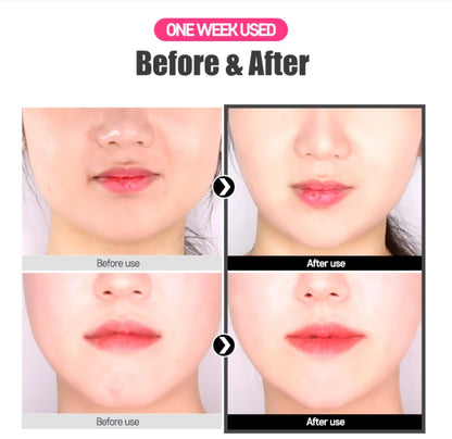 DAYCELL Dr.Band 2 STEP 6g Face Line Corset Skin Elasticity Wrinkles