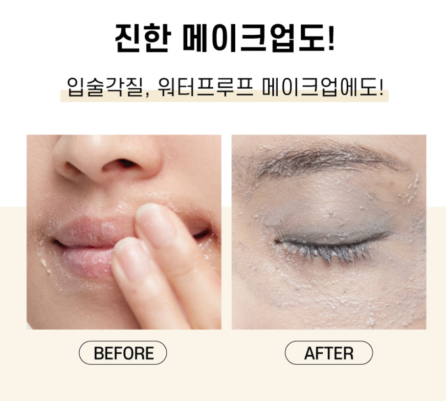 DOCTORCOS Brightening Pineapple Skin Pulling 100ml Pore Peeling Gel