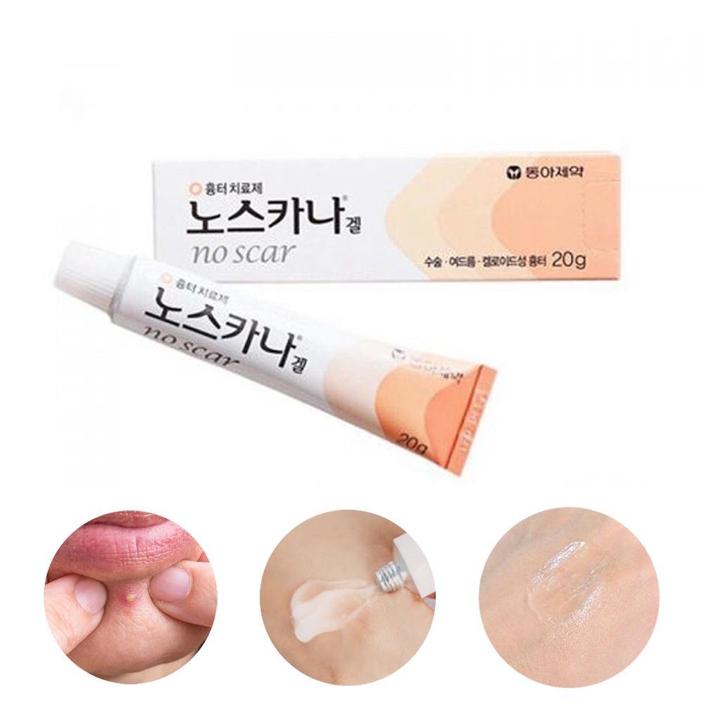Dong-A Pharm Noscarna Acne Scars Removal Gels Face Facial Creams Large Size 20g Best help for getting rid of pimples Decent spot treatment Easy to apply Doesn’t have an odor fading burn