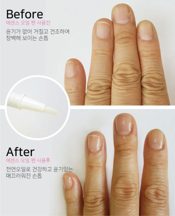 ECHO TOUCH Nail Essence Oil Pen 2ml Korean Self Nail Treatment Beauty