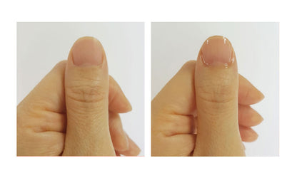 ECHO TOUCH Nail Essence Oil Pen 2ml Korean Self Nail Treatment Beauty