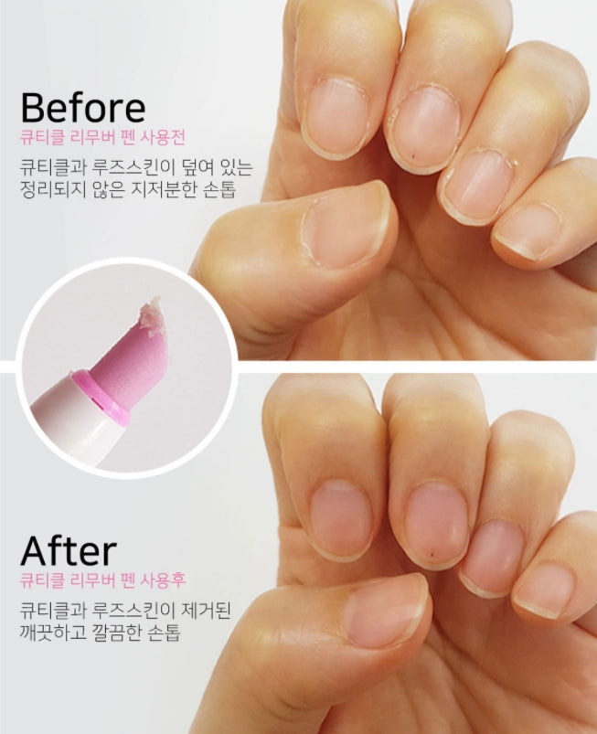 ECHO TOUCH Ceramic Cuticle Remover Pen 2ml Self Nail Treatment Care