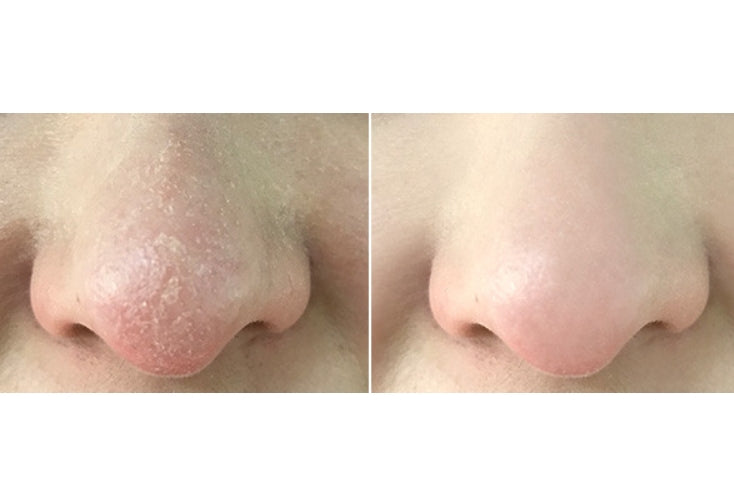 I'm From Rice Mask 110g Brightening  Wash Off Mask Korean Exfoliate