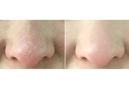 I'm From Rice Mask 110g Brightening  Wash Off Mask Korean Exfoliate