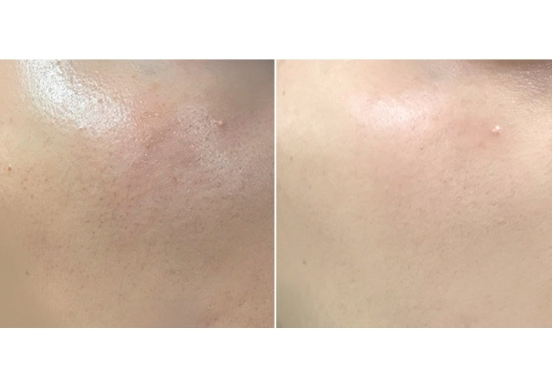 I'm From Rice Mask 110g Brightening  Wash Off Mask Korean Exfoliate