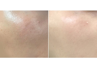 I'm From Rice Mask 110g Brightening  Wash Off Mask Korean Exfoliate