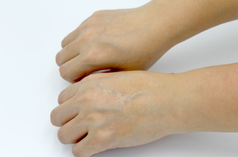 LEBELAGE Repair Black Snail Ampoule 30g Sensitive Skincare Elasticity Moisture Anti Wrinkles