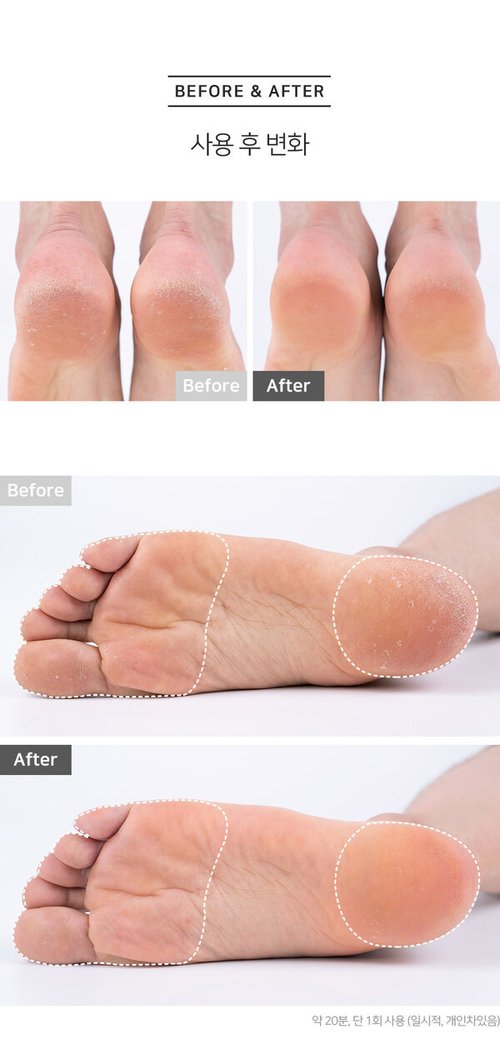 RUBELLI Toe Socks Foot Packs 3 Pairs Feet Care Moisture Moisturizing
