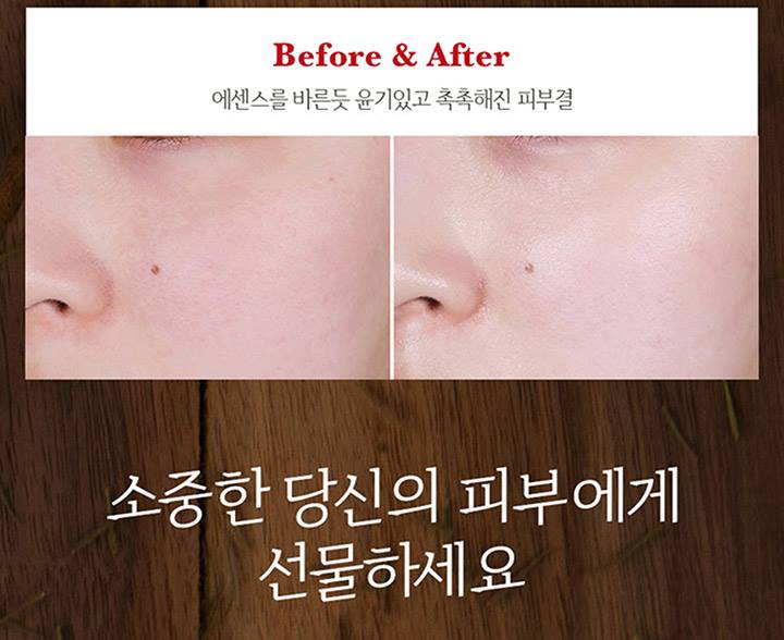 SOORYEHAN Boyun Skin Care Duo Gift Set moisturizing wrinkle soothing