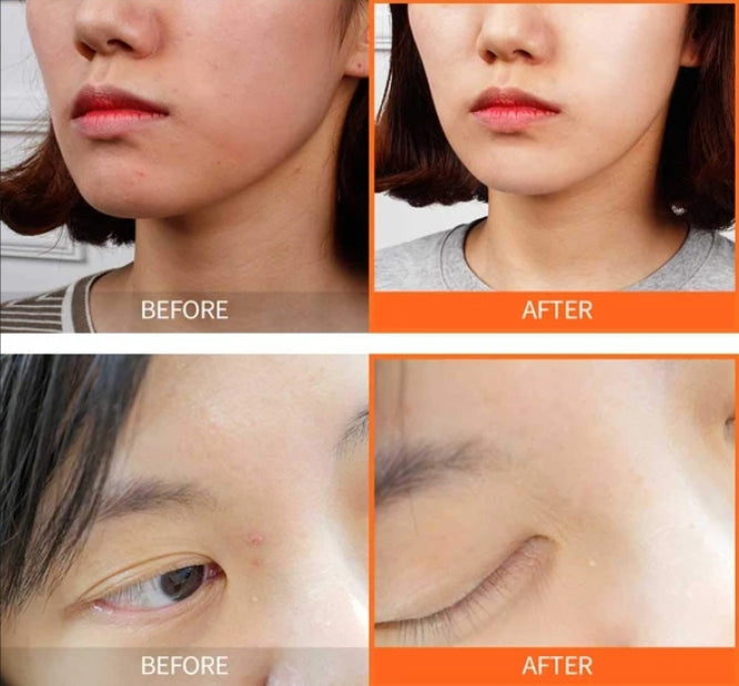 The Yeon Refining Calamine Pink Spot Womens Beauty Cosmetics trouble