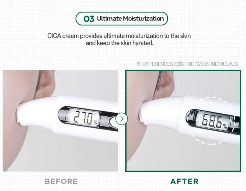 VT Cica Cream 50ml Sensitive Acne Skincare Cooling Moisturizing Soothing