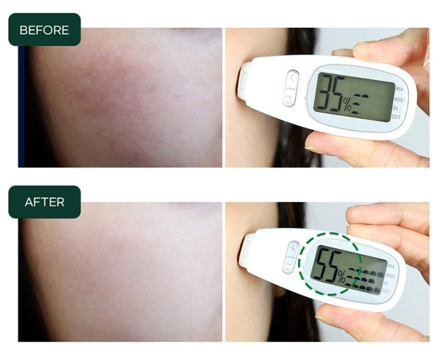 Wellderma Beauty Care Serum & Roller Set Cica Soothing Sensitive Skin