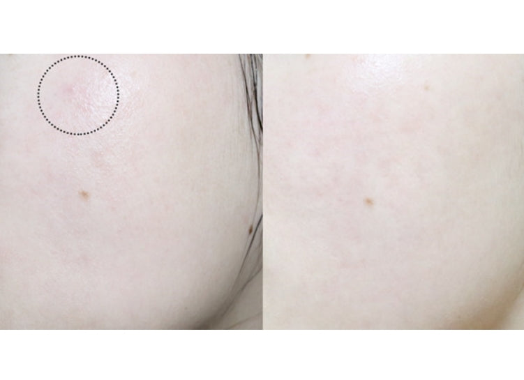 d'ALBA Peptide No-Sebum Balancing Toner 145ml BHA Combination Skincare