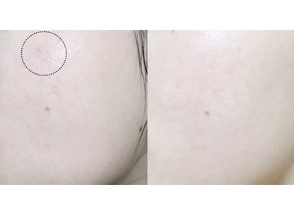 d'ALBA Peptide No-Sebum Balancing Toner 145ml BHA Combination Skincare